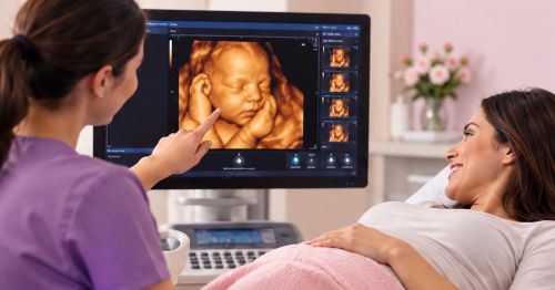 Pregnant patient viewing a 3D 4D ultrasound at Blessings OB/GYN in Peoria, Arizona